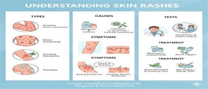 Are skin rashes common with "long haul" COVID-19?