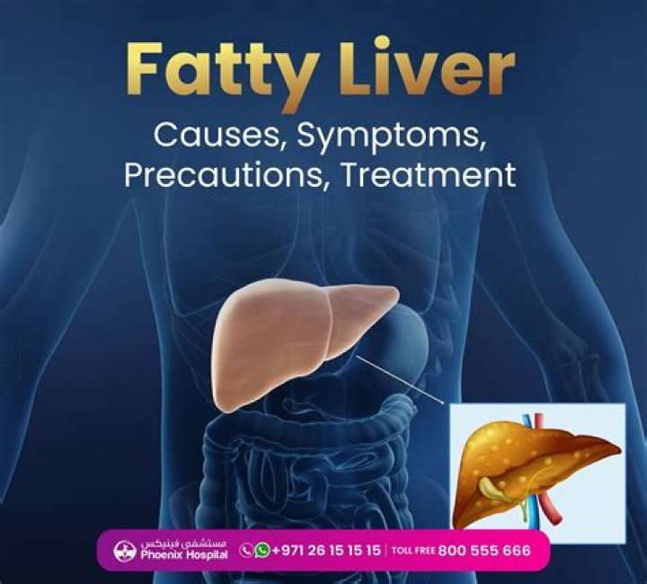Does wine cause fatty liver?