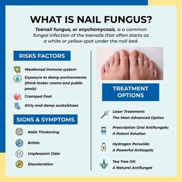 What kills white toenail fungus?