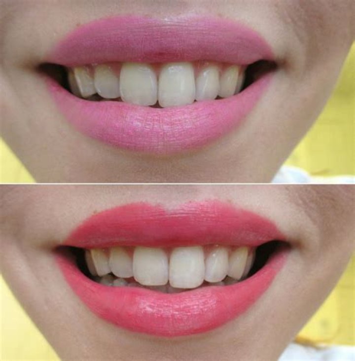 What lip color makes your teeth look whiter?